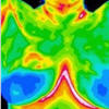 Detect Breast Cancer Early